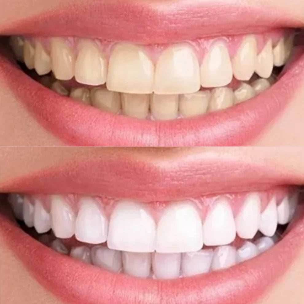 Sérum de correction des couleurs des dents
